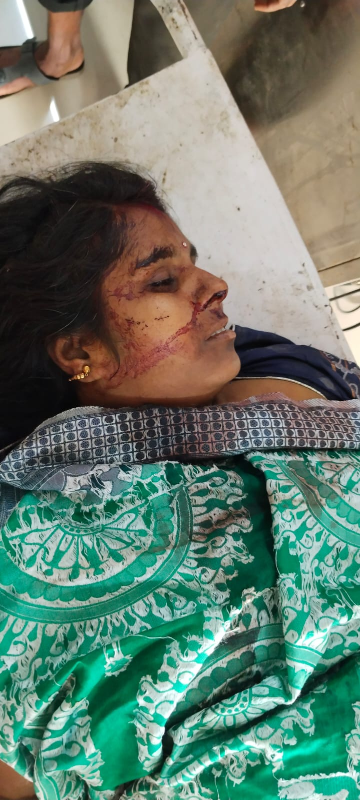 ଟ୍ରକ ଦୁର୍ଘଟଣାରେ ସ୍ତ୍ରୀ ମୃତ ଛୁଆ ଆହାତ : ଅଳ୍ପକେ ବର୍ତିଲେ ସ୍ୱାମୀ